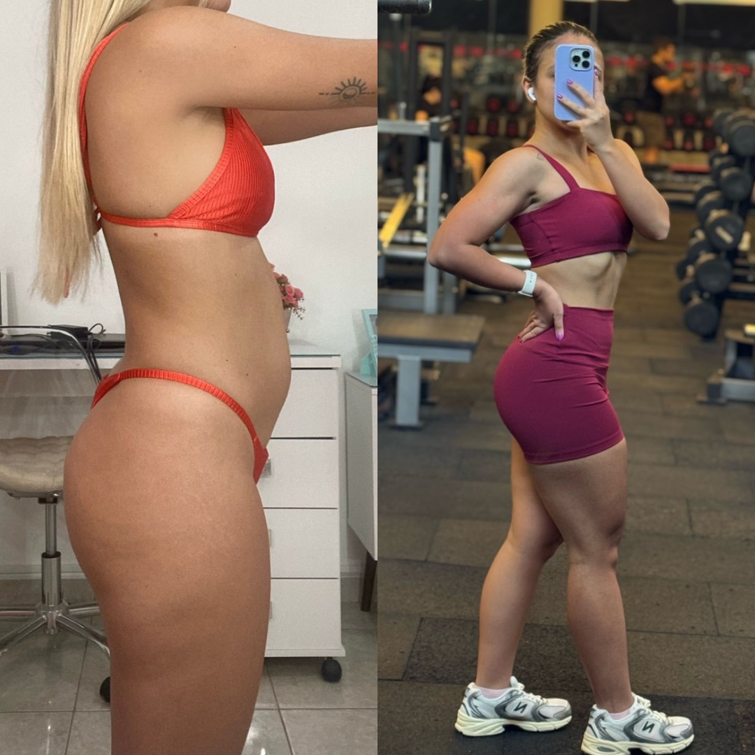 Antes e Depois 6
